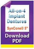 Download All-on-4 Implant Dentures