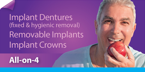 Types Dentures