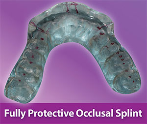 TMJ Splint for TMD Treatment & Therapy Guide