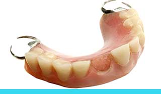 Broken Denture Repairs