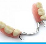 Partial Denture Fixed Removable