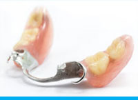 Partial Denture With Clasps